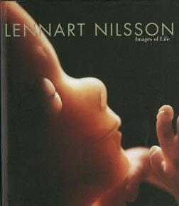Lennart Nilsson "Images of Llife" 1998