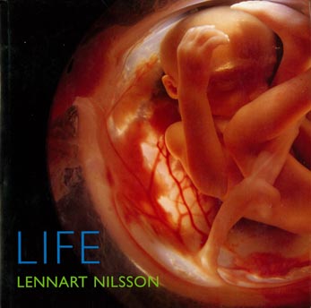 Lennart Nilsson
              "Life" 2006