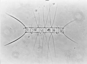 Chaetoceros didymus